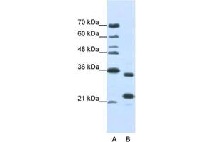Western Blotting (WB) image for anti-AlkB, Alkylation Repair Homolog 8 (ALKBH8) antibody (ABIN2462330) (ALKBH8 Antikörper)