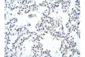 Rabbit Anti-MAF Antibody Catalog Number: ARP38608_P050  Paraffin Embedded Tissue: Human Lung cell  Cellular Data: Epithelial cells of renal tubule Antibody Concentration:  4. (MAF Antikörper  (C-Term))