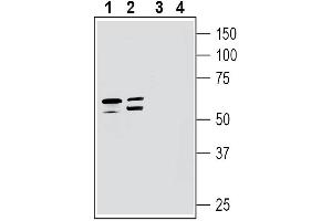 Western blot analysis of human  MG glioma cell line lysates (lanes 1 and 3) and human SH-SY5Y neuroblastoma cell line lysates (lanes 2 and 4):1-2.