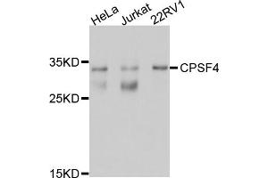 Western blot analysis of extracts of various cell lines, using CPSF4 antibody (ABIN5997508) at 1/1000 dilution. (CPSF4 Antikörper)