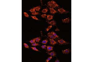Immunofluorescence analysis of C6 cells using PASK antibody (ABIN6128413, ABIN6145248, ABIN6145249 and ABIN6224850) at dilution of 1:100. (PASK Antikörper  (AA 1194-1323))