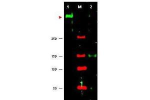Western blot using  anti-ATR antibody shows detection of ATR in HeLa cell nuclear extract (lane 1). (ATR Antikörper  (Internal Region))