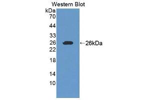 Western blot analysis of the recombinant protein. (Ninein Antikörper  (AA 1-153))