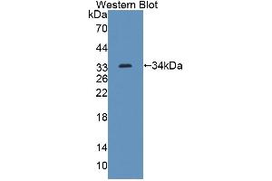 Figure. (ABCG8 Antikörper  (AA 1-272))