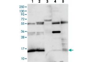 Western blot analysis of Lane 1: RT-4, Lane 2: U-251 MG, Lane 3: Human Plasma, Lane 4: Liver, Lane 5: Tonsil with FAM103A1 polyclonal antibody  at 1:250-1:500 dilution. (FAM103A1 Antikörper)