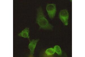 Immunocytochemistry staining of Hela using Eg5 mouse mAb (1:200). (KIF11 Antikörper)