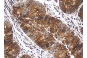 Image no. 3 for anti-Signal Recognition Particle Receptor, B Subunit (SRPRB) antibody (ABIN1501128) (SRPRB Antikörper)