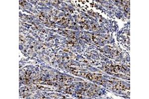 Immunohistochemistry (Paraffin-embedded Sections) (IHC (p)) image for anti-Caspase 3 (CASP3) (cleaved) antibody (ABIN7073336)