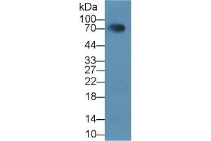 Detection of HCAM in Rat Serum using Polyclonal Antibody to Homing Associated Cell Adhesion Molecule (HCAM) (HCAM Antikörper  (AA 24-182))