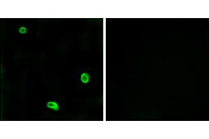 Immunofluorescence analysis of LOVO cells, using R4 antibody. (F2RL3 Antikörper)