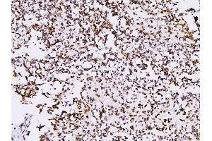 IHC analysis of PHF21A using anti-PHF21A antibody (ABIN6719353).