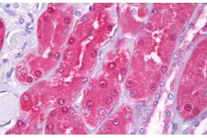 Anti-HIP1 antibody IHC staining of human kidney, tubules. (HIP1 Antikörper  (AA 928-1038))