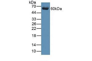 Figure. (beta Arrestin 1 Antikörper  (AA 3-246))