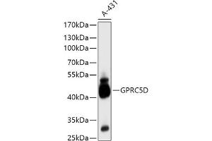 Western blot analysis of extracts of A-431 cells, using GPRC5D antibody (ABIN7267317) at 1:1000 dilution. (GPRC5D Antikörper  (AA 264-345))
