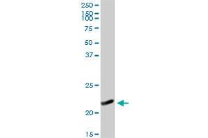 NDUFB10 MaxPab rabbit polyclonal antibody.
