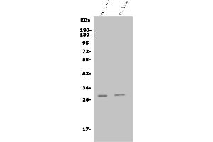 Western blot analysis of Insig1 using anti-Insig1 antibody (ABIN7603176).