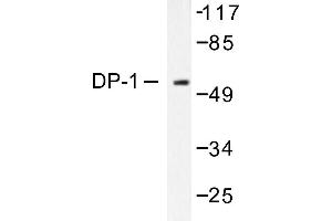 Image no. 1 for anti-Transcription Factor Dp-1 (TFDP1) antibody (ABIN265387)