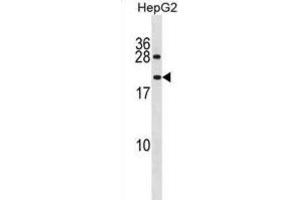 Western Blotting (WB) image for anti-Peptidylprolyl Isomerase A (Cyclophilin A)-Like 4A (PPIAL4A) antibody (ABIN3001342) (PPIAL4A Antikörper)