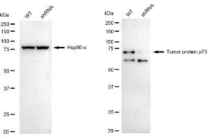 Western blotting analysis using tumor protein p73 antibody (ABIN7800694).