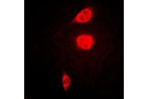 Immunofluorescent analysis of ATF1 staining in KNRK cells. (AFT1 Antikörper  (C-Term))