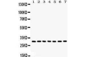 Anti- NQO1 Picoband antibody, Western blotting All lanes: Anti NQO1  at 0. (NQO1 Antikörper  (C-Term))