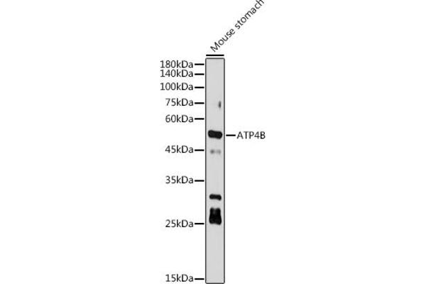 ATP4b Antikörper