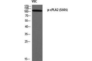 Western Blot (WB) analysis of VEC using p-cPLA2 (S505) antibody. (PLA2G4A Antikörper  (pSer505))