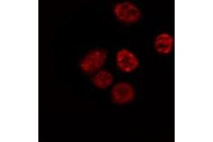ABIN6267564 staining Hela by IF/ICC. (Histone H4 Antikörper  (acLys5))