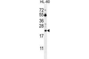 Western blot analysis in HL-60 cell line lysates (35ug/lane) using Prothymosin alpha Antibody (N-term).