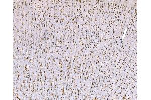 IHC analysis of SND1 using anti-SND1 antibody (ABIN7600526). (SND1 Antikörper  (AA 20-204))