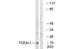 Western blot analysis of extracts from COLO cells, using TCEAL1 Antibody. (TCEAL1 Antikörper  (AA 91-140))
