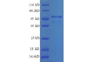 SDS-PAGE (SDS) image for Breast Cancer Metastasis Suppressor 1 (BRMS1) (AA 1-235), (partial) protein (GST tag) (ABIN5712363)