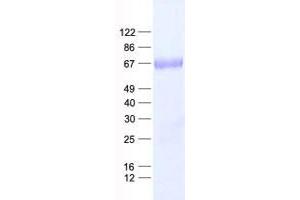 Validation with Western Blot (NARFL Protein (His tag))