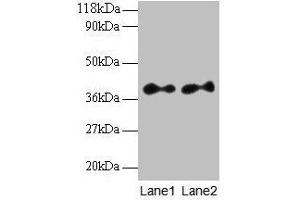 Western blot All lanes: SCAMP3 antibody at 2 μg/mL Lane 1: EC109 whole cell lysate Lane 2: 293T whole cell lysate Secondary Goat polyclonal to rabbit IgG at 1/15000 dilution Predicted band size: 39, 36 kDa Observed band size: 39 kDa (SCAMP3 Antikörper  (AA 2-170))