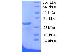 SDS-PAGE (SDS) image for ATPase, H+/K+ Exchanging, beta Polypeptide (ATP4b) (AA 58-291), (Extracellular) protein (His tag) (ABIN4975517) (ATP4b Protein (AA 58-291, Extracellular) (His tag))