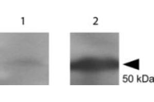 Western blot using  Anti-tetanus toxin C antibody shows detection of a protein band at 52 kDa corresponding to full length 6X HIS-TTFC fusion protein (arrowhead). (Tetanus Toxin C-Fragment (TTC) Antikörper)