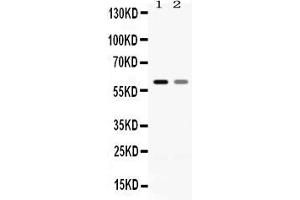 Western blot analysis of EAAT1 expression in rat brain extract ( Lane 1) and mouse brain extract ( Lane 2).