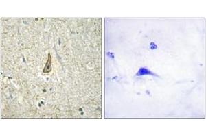 Immunohistochemistry analysis of paraffin-embedded human brain, using Cytochrome P450 26C1 Antibody. (CYP26C1 Antikörper  (AA 41-90))