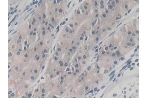 Detection of NGAL in Human Stomach Tissue using Monoclonal Antibody to Neutrophil gelatinase-associated lipocalin (NGAL) (Lipocalin 2 Antikörper  (AA 21-198))