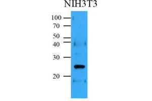 Western Blotting (WB) image for anti-B-Cell CLL/lymphoma 2 (BCL2) antibody (ABIN567617) (Bcl-2 Antikörper)