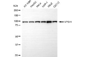 Western blotting analysis using VPS41 antibody (ABIN7800815). (Rekombinanter VPS41 Antikörper)