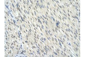 Rabbit Anti-KLF10 antibody        Paraffin Embedded Tissue:  Human Heart cell   Cellular Data:  Epithelial cells of renal tubule  Antibody Concentration:   4.