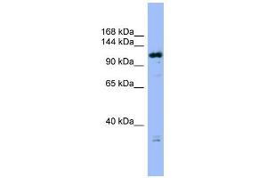 FAM29A antibody used at 1 ug/ml to detect target protein. (FAM29A Antikörper  (Middle Region))