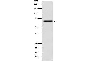 Western blot analysis of MADCAM1 expression in HUVEC cell lysate.