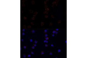 Immunofluorescence analysis of THP-1 cells using CD33 antibody.