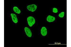 Immunofluorescence of purified MaxPab antibody to HNRNPL on HeLa cell. (HNRNPL Antikörper  (AA 1-558))