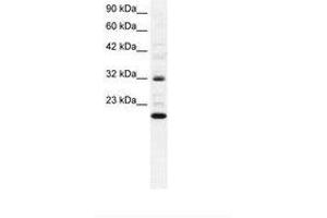 Image no. 1 for anti-rho GDP Dissociation Inhibitor (GDI) gamma (ARHGDIG) (AA 42-90) antibody (ABIN6735819)