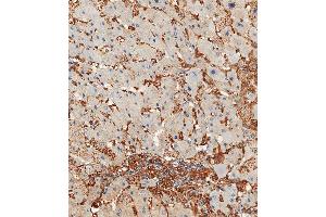 Immunohistochemical analysis of paraffin-embedded Human hepatocarcinoma tissue using A performed on the Leica® BOND RXm. (Annexin V Antikörper  (N-Term))