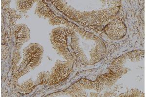 ABIN6278644 at 1/100 staining Mouse colon tissue by IHC-P. (TMPRSS3 Antikörper  (Internal Region))