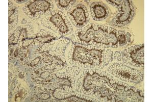 Immunohistochemistry (IHC) image for anti-B-Raf proto-oncogene, serine/threonine kinase (BRAF) antibody (ABIN7598779) (BRAF Antikörper)